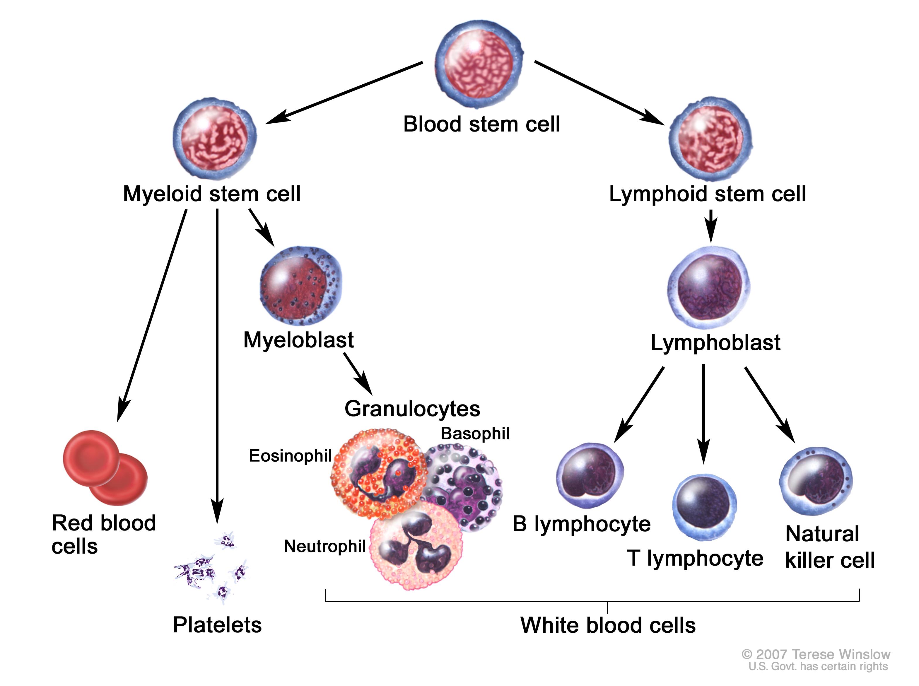 What is Acute Lymphoblastic Leukemia?